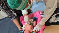 BAYI perempuan ditemukan di dalam kardus di Jalan Gunung Lawu, Denpasar Barat, saat mendapat perawatan medis. Foto: ist BAYI perempuan ditemukan di dalam kardus di Jalan Gunung Lawu, Denpasar Barat, saat mendapat perawatan medis. Foto: ist