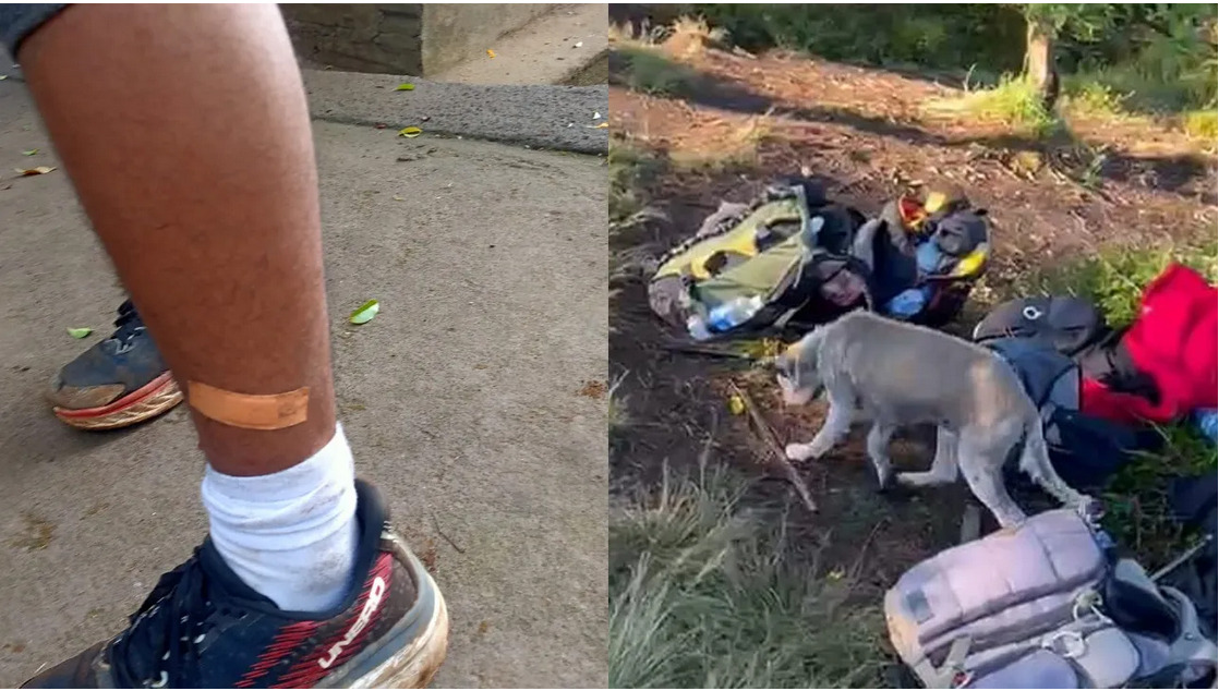 KORBAN gigitan anjing liar di Gunung Batukaru. Foto: ist